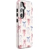image:imageCasely Galaxy S24 Case  Pura Vida  Coastal Checkers  Essential Slim DualLayer Protective DesignCoquette Girlie  Pastel Bows