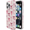 image:imageCasely iPhone 14 Pro Max Case  Art of Chaos  Grateful Dead Skull  Compatible with MagSafe  Classic Ultra Slim DesignLover Girlie  Pink Bows