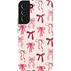 Lover Girlie | Pink Bows
