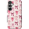 Lover Girlie | Pink Bows