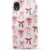 Lover Girlie | Pink Bows